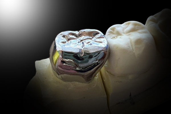 ハイクオリティな技工物