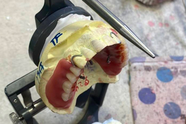 担当制の歯科技工