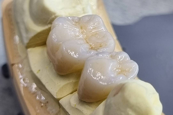 技工物ジルコニア