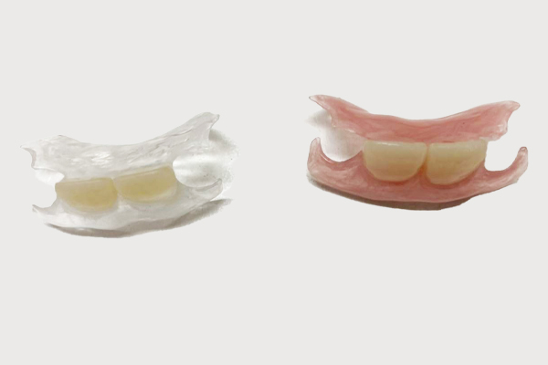 技工物ノンクラスプデンチャー